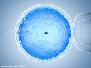 PGT三代试管